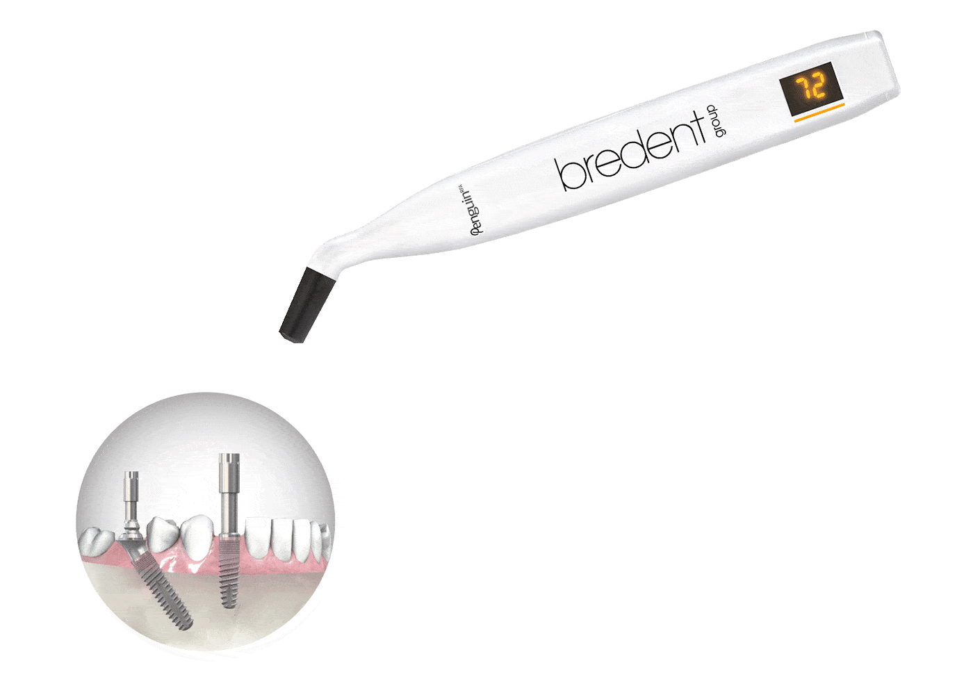 bredent Penguin RFA solution