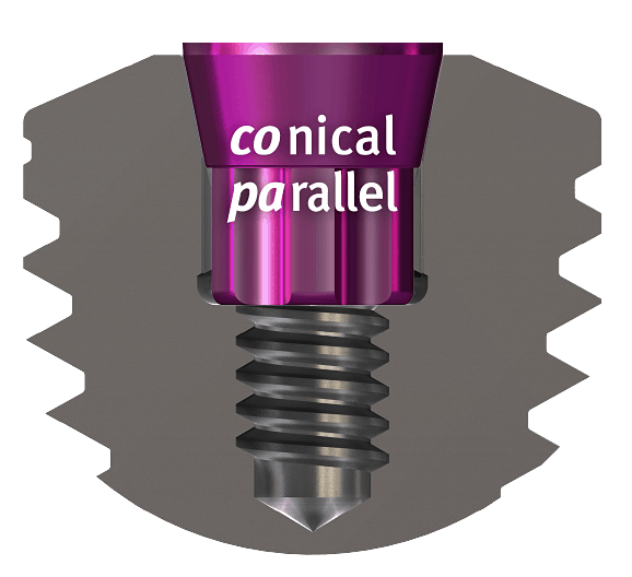 copaSKY Connical Parallel Connection Implant