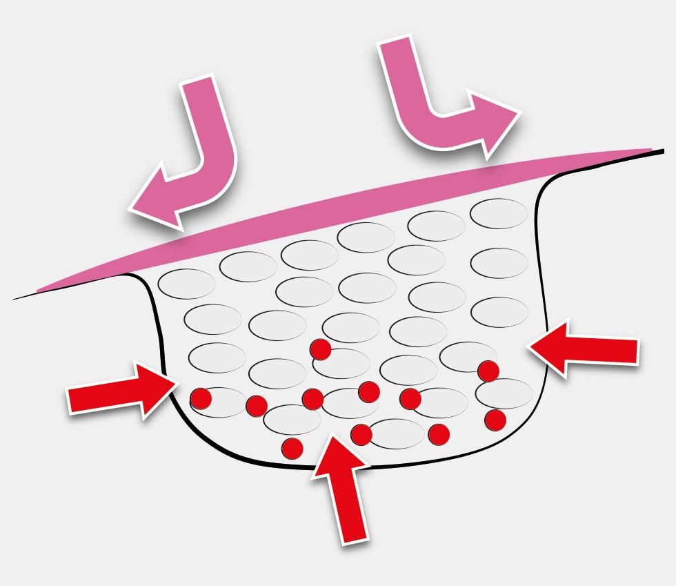 Tixxu Control - Funtionality Of Membrane by bredent-group