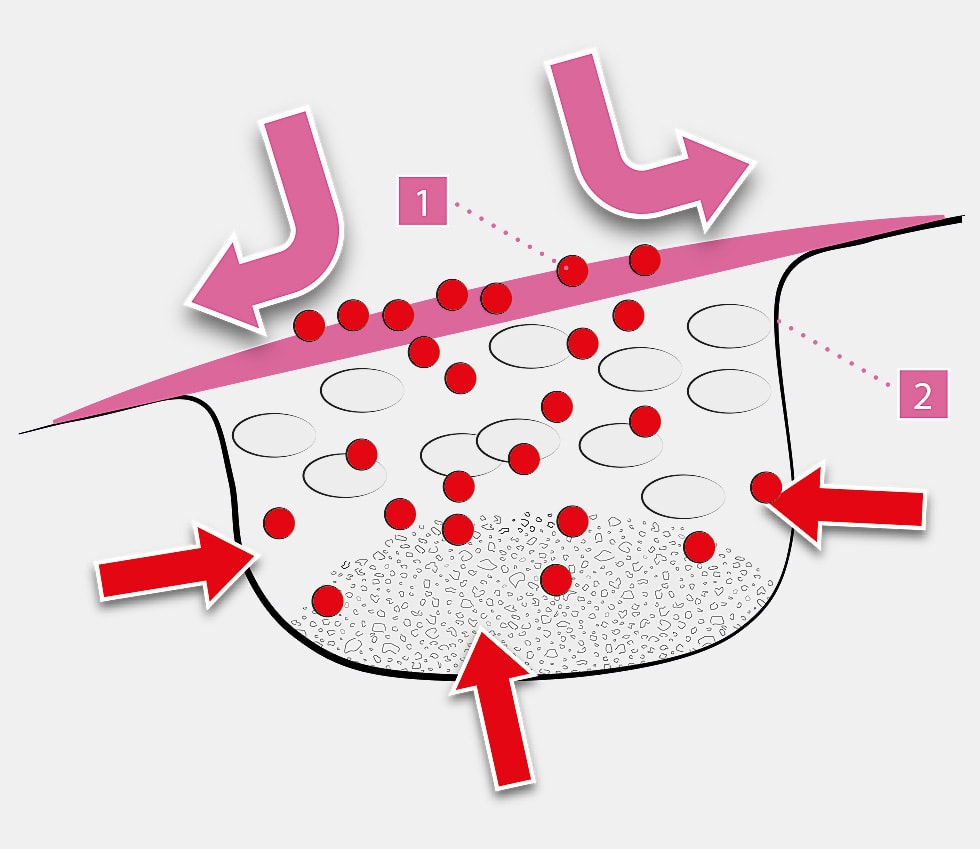 Tixxu Control - Funtionality Of Membrane by bredent-group