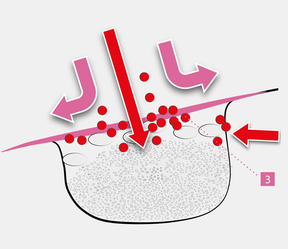 Tixxu Control - Funtionality Of Membrane by bredent-group