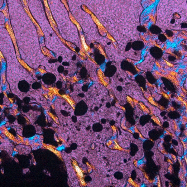 TIXXU Graft Gradual Biodegradation