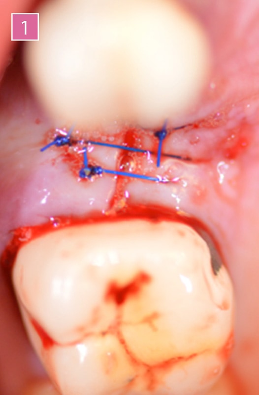 TIXXU Control - Clinical case