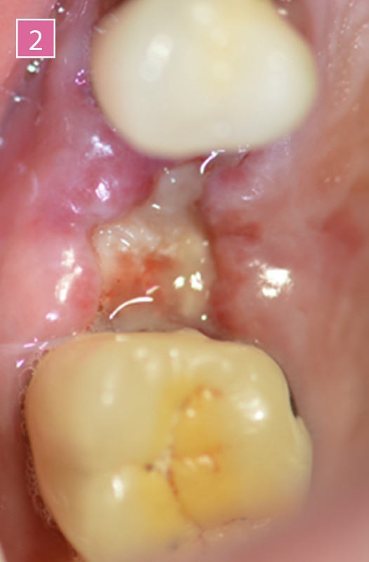 TIXXU Control - Clinical case