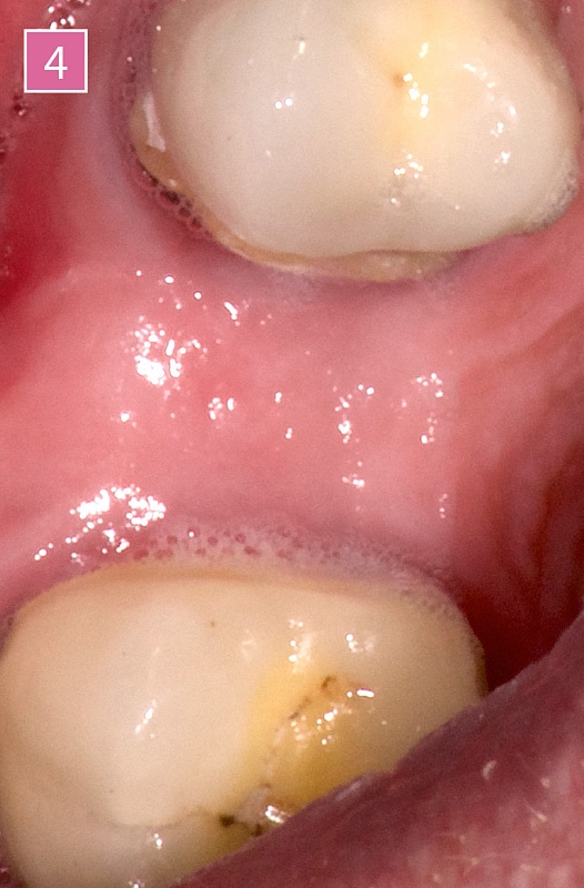 TIXXU Control - Clinical case