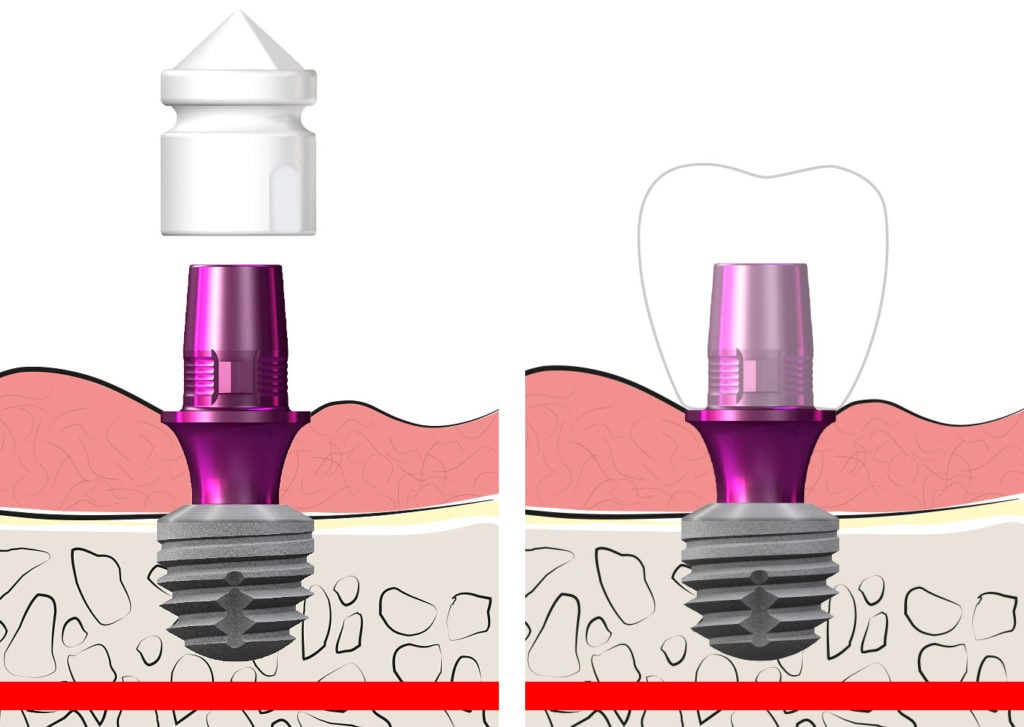 copaSKY Digital CEREC