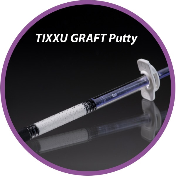 TIXXU Graft Putty by bredent-group