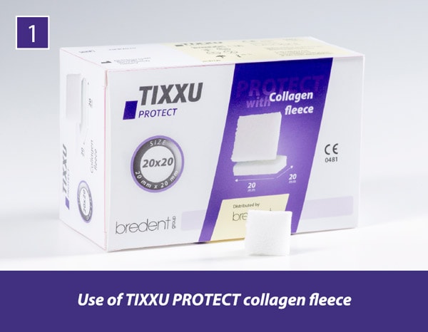 TIXXU Protect Clinical Case 1